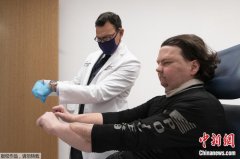 永利皇宫入口412线路:重获新生！男子成功完成换脸换手手术 为